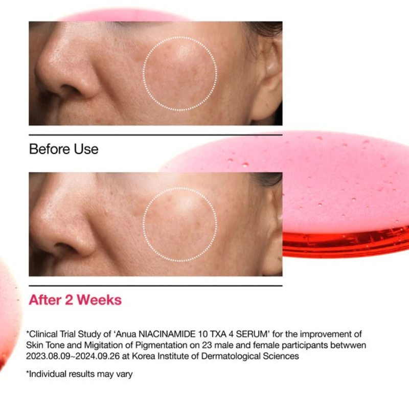 Anua - Niacinamide 10 TXA 4 Serum